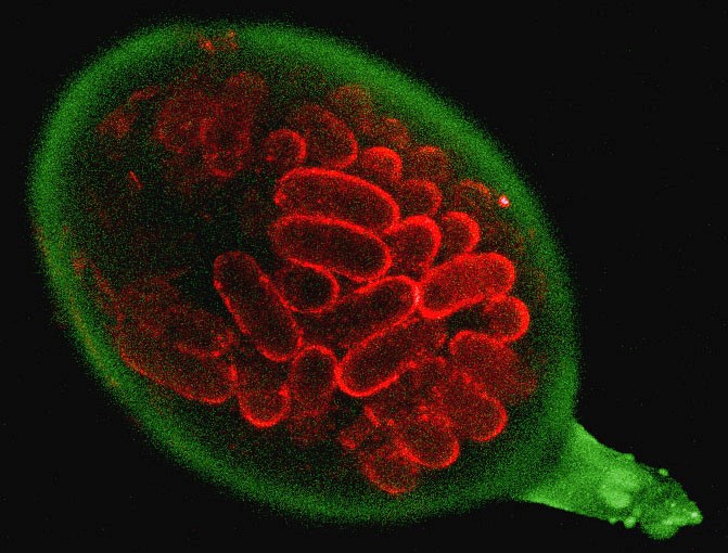 Female potato cyst nematode containing eggs