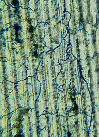 Endophytic fungi (stained blue) living within fescue grass leaves