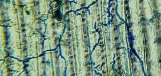 endophytic fungi